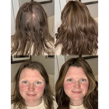 ✨✨ Final Hours – 2026 New Lightweight & Breathable Wavy Hair Topper