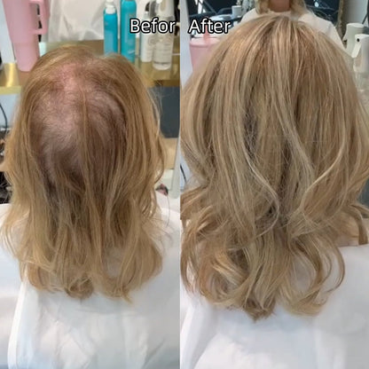 ✨✨ Final Hours – 2026 New Lightweight & Breathable Wavy Hair Topper
